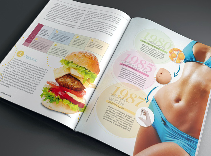 Gráficos para revista de liposapiração Gráficos para revista de liposapiração
