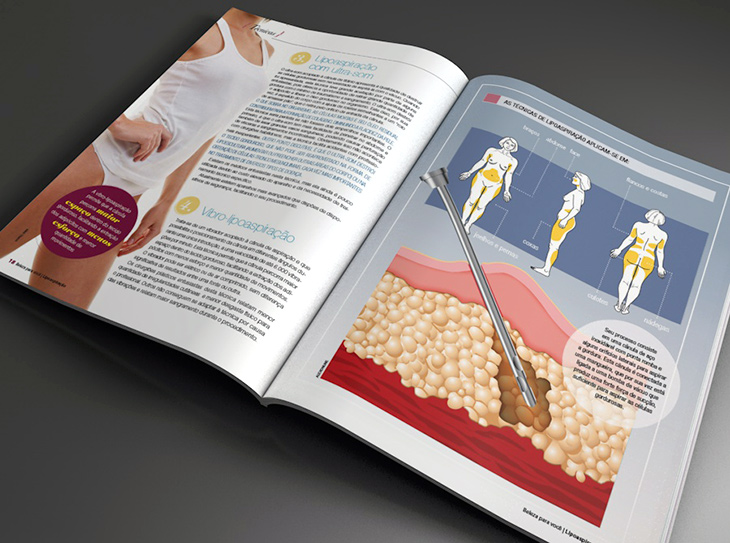 Diagramação interna revista liposapiração Diagramação interna revista liposapiração